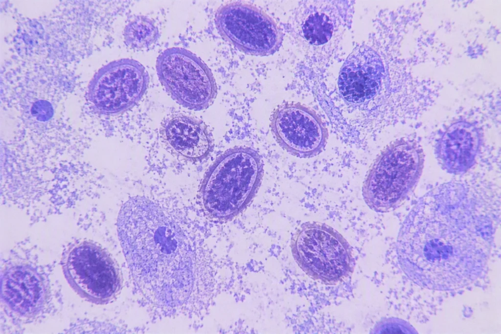 mpox_aspb_2d